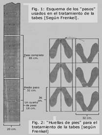 Caso clínico sobre el tratamiento fisioterapéutico de un paciente con atrofia multisistémica