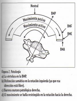 Alternativas de tratamiento en la lesión osteopática o disfunción somática