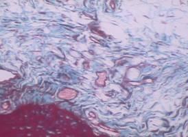 Morfometria arteriolar comparativa de tendão calcâneo de ratos normais e de tendão calcâneo de ratos após o uso da crochetagem