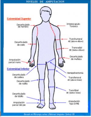 Programa de ejercicios para el manejo de pacientes amputados trastabilles pre-protésicos y manejo de dolor fantasma