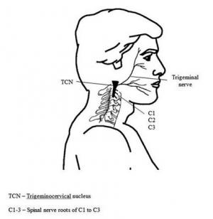 Cefalea cervicogénica. Revisión bibliográfica