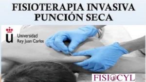 Fisioterapia invasiva: Puntos gatillo y punción seca en el dolor musculoesquelético