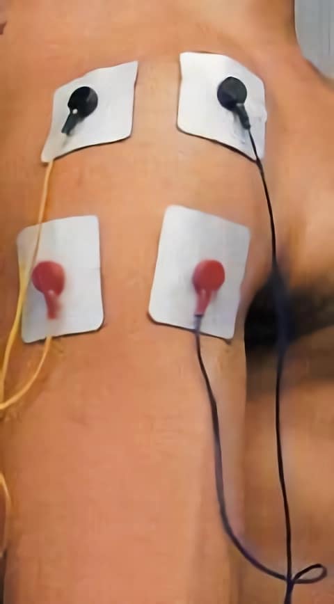 Guía para la colocación de electrodos en fisioterapia - Blog de fisioterapia