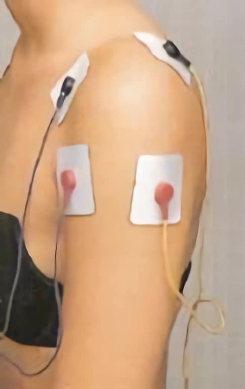 Colocación de los electrodos según los músculos - Electrotens