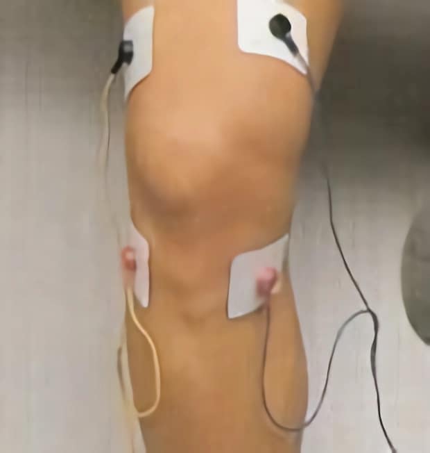 https://www.efisioterapia.net/tienda/img/cms/colocacion-electrodos-dolor-rodilla.jpg