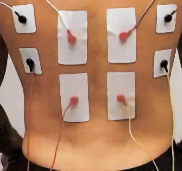 https://www.efisioterapia.net/tienda/img/cms/colocacion-electrodos-dorsal-ancho.jpg