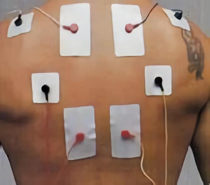 Guía para la colocación de electrodos en fisioterapia - Blog de