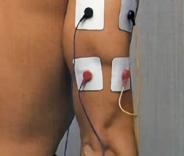 https://www.efisioterapia.net/tienda/img/cms/colocacion-electrodos-triceps.jpg